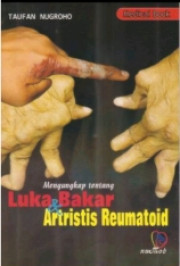 MENGUNGKAP TENTAN LUKA BAKAR DAN ARTRISTIS REUMATOROID